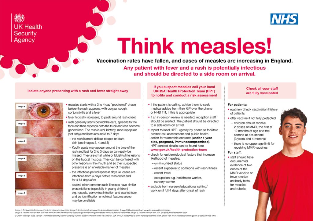 Ukhsa12724thinkmeasleshcwposter09web